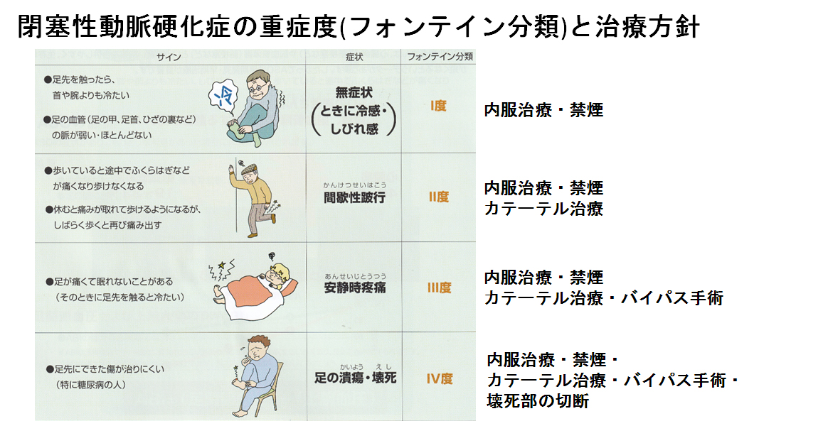 循環器内科 独立行政法人 国立病院機構 栃木医療センター