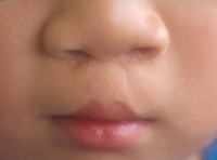 歯科 歯科口腔外科 小児歯科 独立行政法人 国立病院機構 栃木医療センター