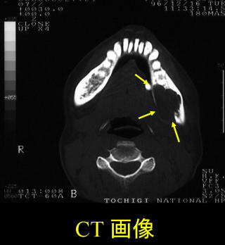 歯科 歯科口腔外科 小児歯科 独立行政法人 国立病院機構 栃木医療センター