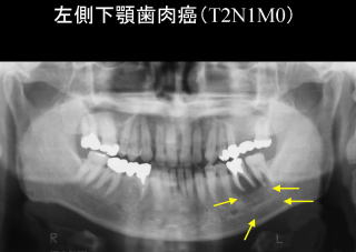 歯科 歯科口腔外科 小児歯科 独立行政法人 国立病院機構 栃木医療センター